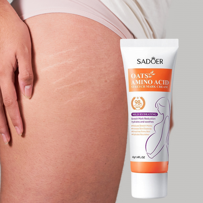 Stretch Marks Removal Cream