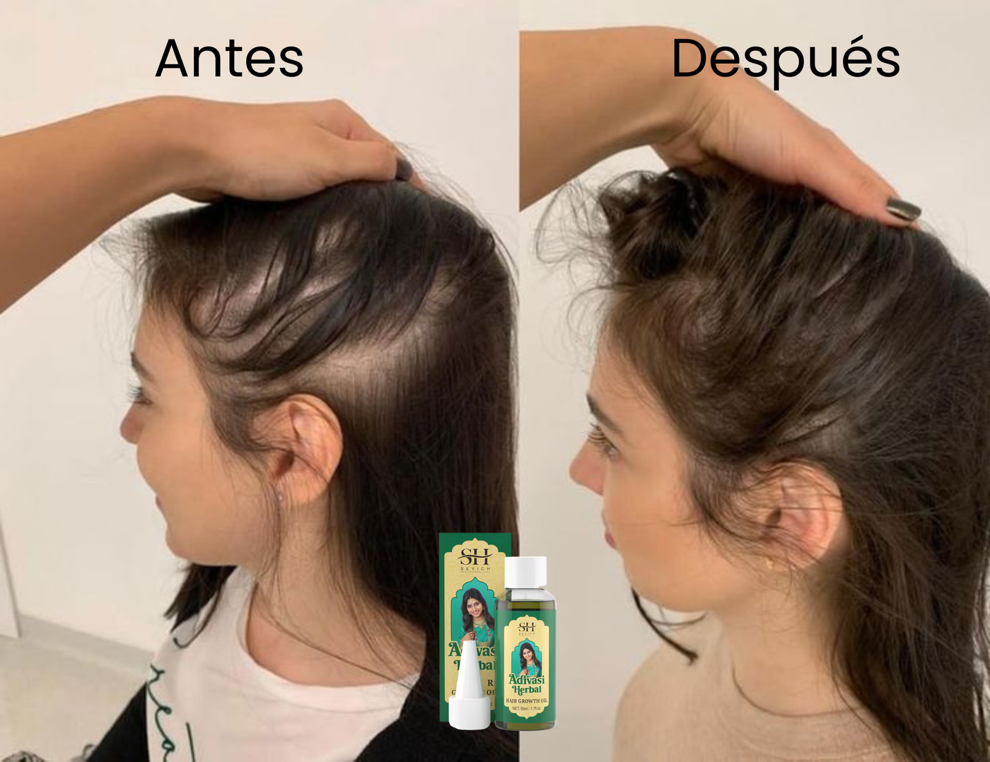 Aceite Herbal para el Crecimiento del Cabello