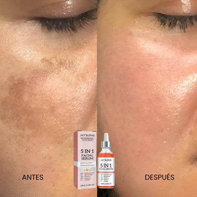 Suero Facial Profesional 5 en 1 