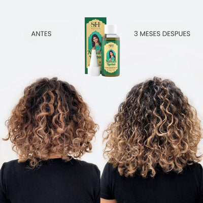 Aceite Herbal para el Crecimiento del Cabello