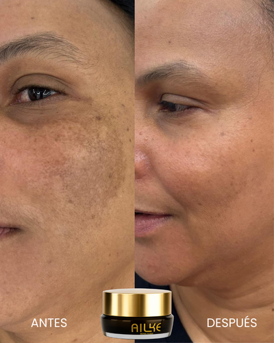8K Intensive Anti-Spot Cream