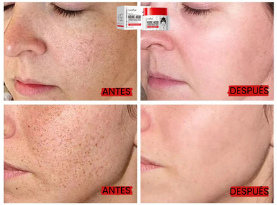 Crema Facial Aclarante con Ácido Kójico