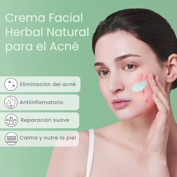 Crema Antiacné