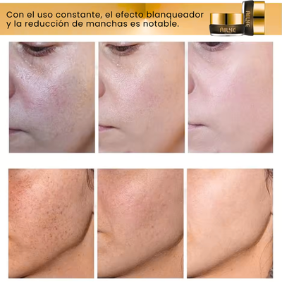 8K Intensive Anti-Spot Cream