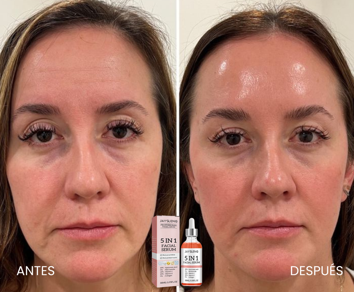 Suero Facial Profesional 5 en 1 