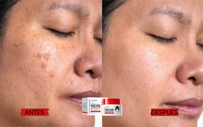Crema Facial Aclarante con Ácido Kójico