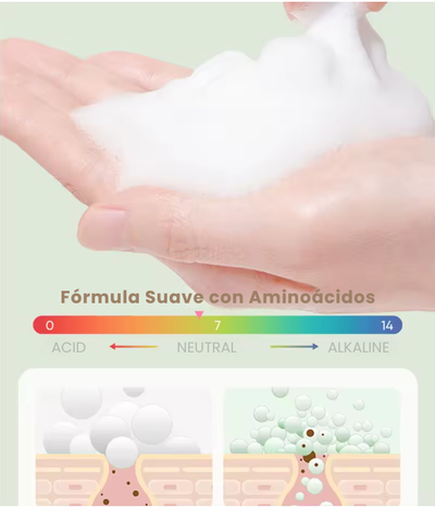 Acne Cream