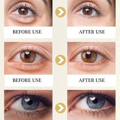 Magical Eye Cream Treatment