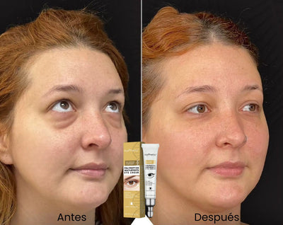 Crema Hidratante Correctora de Bolsas y Ojeras 