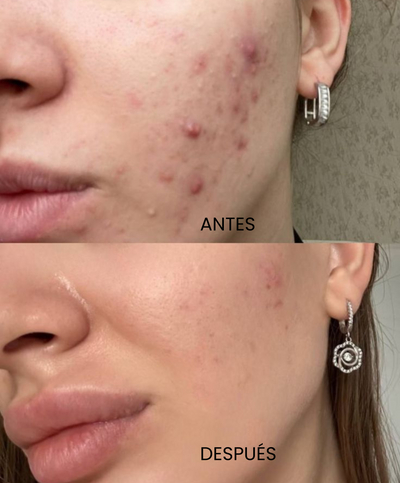 Serum Glycolic Acid