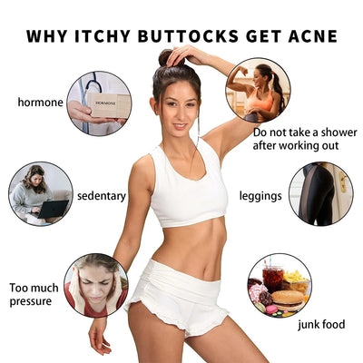 Butt Acne Treatment Cream