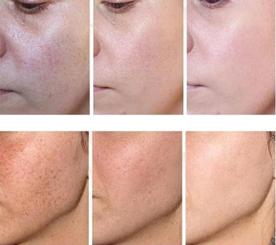 Kojic Acid Whitening Face Cream