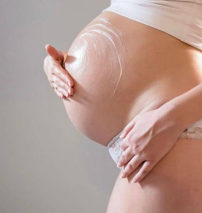 Stretch Marks Removal Cream