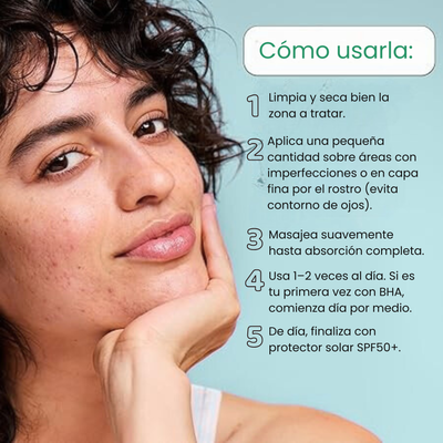Blackhead Control