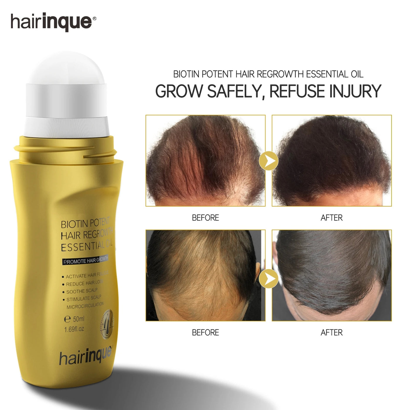 Hair Growth Roller Treatment